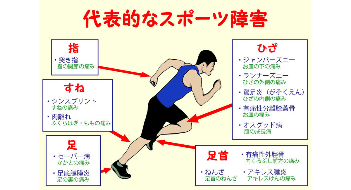 茅ヶ崎駅徒歩４分のチガサキ整骨院のオスグッドの整体をご紹介。長引くオスグッドの痛み、再発するオスグッドの痛み、安静にしても・ストレッチをしても改善しない痛み、運動を休まなければならないオスグッドの痛みでお困りの方は、チガサキ整骨院の整体で改善。今すぐご相談ください！