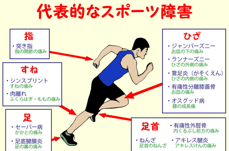 茅ヶ崎駅徒歩４分のチガサキ整骨院のオスグッドの整体をご紹介。長引くオスグッドの痛み、再発するオスグッドの痛み、安静にしても・ストレッチをしても改善しない痛み、運動を休まなければならないオスグッドの痛みでお困りの方は、チガサキ整骨院の整体で改善。今すぐご相談ください！