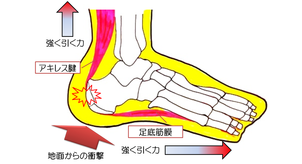 シーバー病でお困りの方へ 藤沢市たちばな通り整骨院